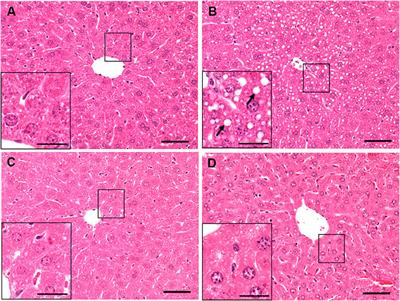 Acute ethanol-induced liver injury is prevented by betaine administration